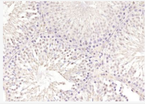 Anti-SKA3 antibody-纺锤体和着丝粒相关蛋白3抗体