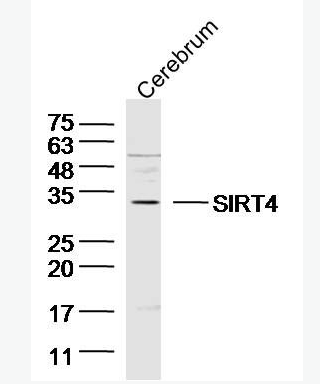 Anti-SIRT4 antibody-沉默调节相关蛋白4抗体