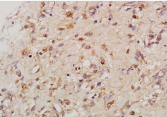 Anti-TNF alpha antibody-肿瘤坏死因子-α抗体