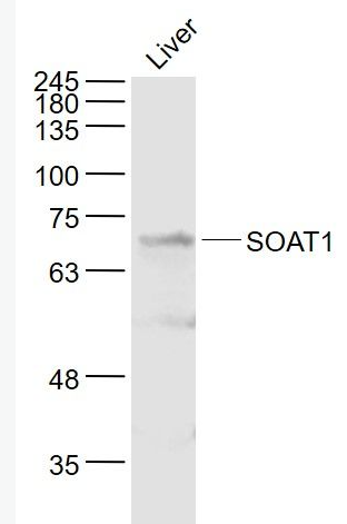 Anti-SOAT1 antibody-胆固醇酰基转移酶1抗体