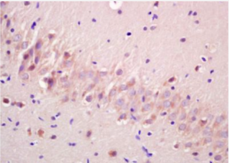 Anti-phospho-GSK3A (Ser21) antibody-磷酸化糖原合酶激酶-3α抗体