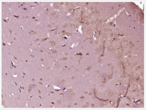 Anti-FSCN1 antibody-肌动蛋白结合蛋白Fascin抗体
