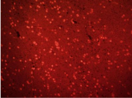 Anti-MAGEA2 antibody-黑色素瘤相关抗原2抗体