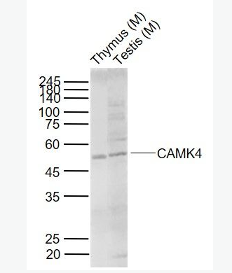 Anti-CAMK4 antibody-钙/钙调蛋白依赖性蛋白激酶4抗体
