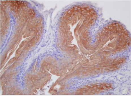 Anti-Laminin 5 antibody-层粘连蛋白5抗体
