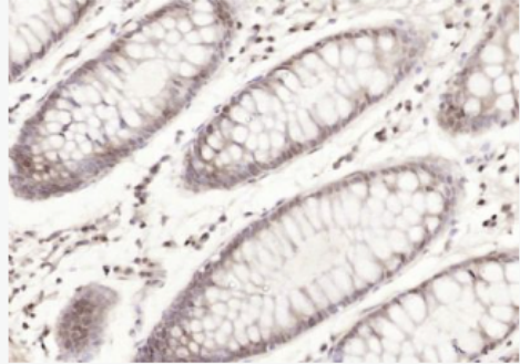 Anti-Cyclophilin F  antibody-亲环蛋白（亲环素）PPIF抗体