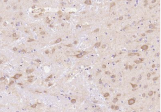 Anti-CIDE A antibody-DNA断裂因子相似蛋白A抗体