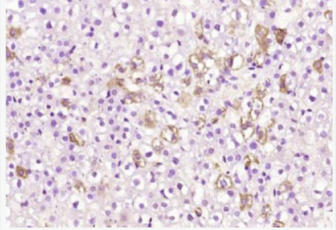 Anti-PARP4 antibody-蛋白质单ADP核糖基转移酶PARP4抗体