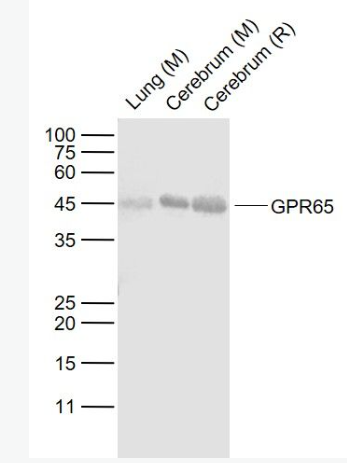 Anti-GPR65 antibody-G蛋白偶联受体65抗体