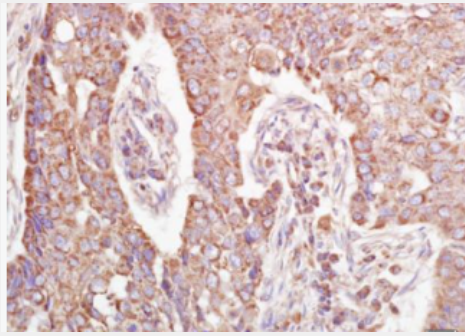 Anti-UQCRC1 antibody-辅酶细胞色素C还原酶核心蛋白1抗体