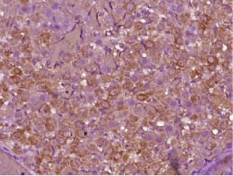Anti-LHR antibody-促黄体生成素受体抗体