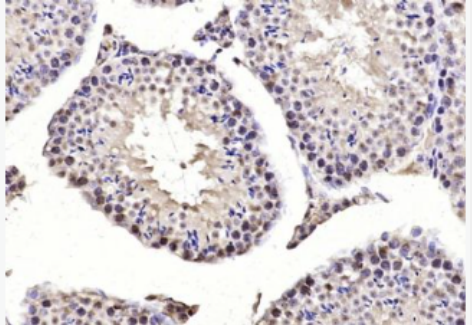 Anti-MIS12 antibody-染色体及有丝分裂蛋白MIS12抗体