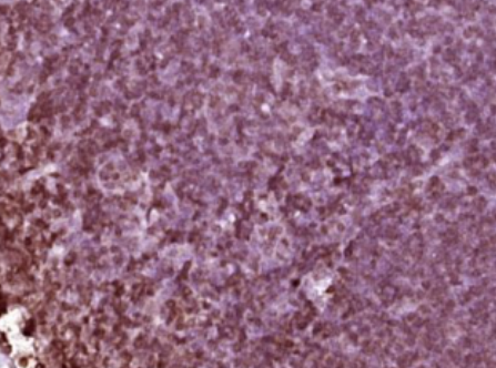 Anti-PRDM1 antibody-PRDM1抗体