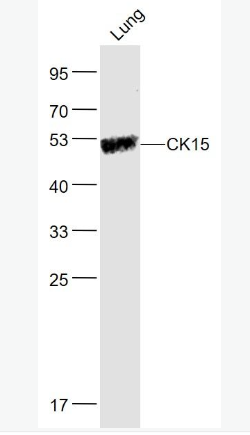Anti-CK15 antibody-细胞角蛋白15抗体