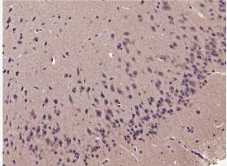 Anti-Proteasome 19S 10B antibody-蛋白酶体PRS10B抗体