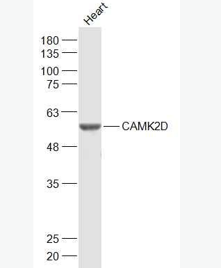 Anti-CaMKII delta antibody-钙/钙调素依赖蛋白激酶2D(CaMKIIδ)抗体