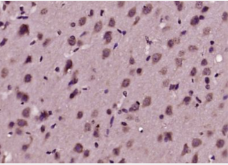 Anti-SORBS2 antibody-精氨酸结合蛋白2抗体