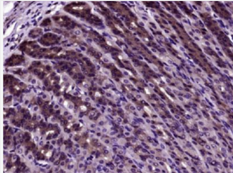 Anti-SMURF1 antibody-Smad蛋白E3泛素连接酶1抗体.