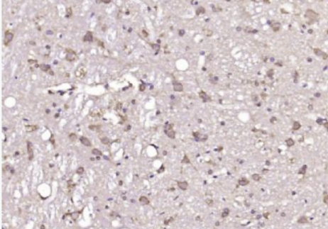 Anti-GNAI2/G protein alpha inhibitor 1 antibody-G蛋白α抑制蛋白1抗体