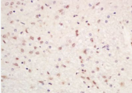 Anti-SETDB1/KMT1E antibody-组蛋白H3K9甲基转移酶4抗体