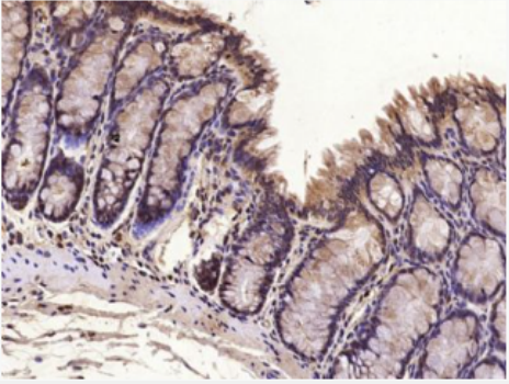 Anti-TCF12 antibody-转录因子12抗体