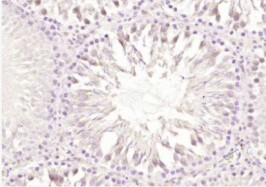 Anti-GIPC-2 antibody-胞浆区相关蛋白GIPC2抗体