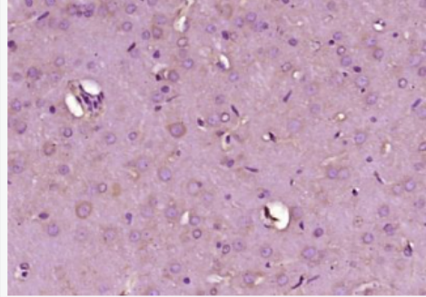 Anti-CaMKK1 antibody-钙调蛋白激酶激酶α抗体CaMKKα