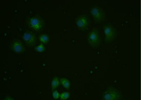 Anti-ox-LDL antibody-氧化低密度脂蛋白抗体