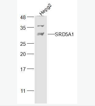 Anti-SRD5A1  antibody-类固醇5α还原酶1抗体
