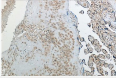 Anti-RTL8C antibody-反转录转座子Gag样蛋白8C抗体