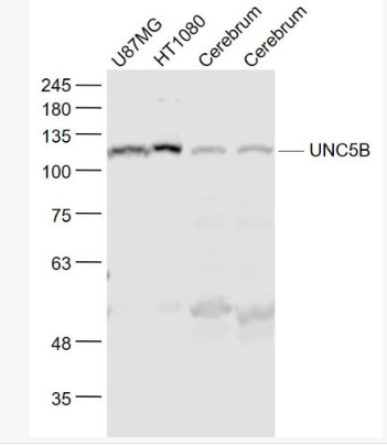 Anti-UNC5B  antibody-神经突起诱导因子受体UNC5B抗体