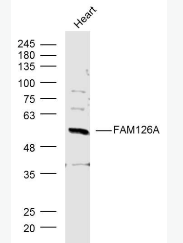 Anti-FAM126A antibody-髓鞘缺陷相关蛋白抗体