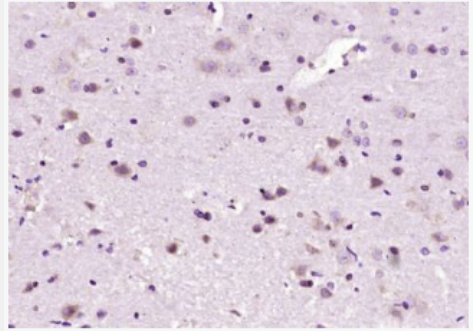 Anti-Zic2 antibody-锌指蛋白Zic2抗体