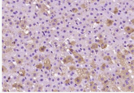 Anti-Adrenodoxin antibody-肾上腺皮质线粒体铁氧还蛋白抗体