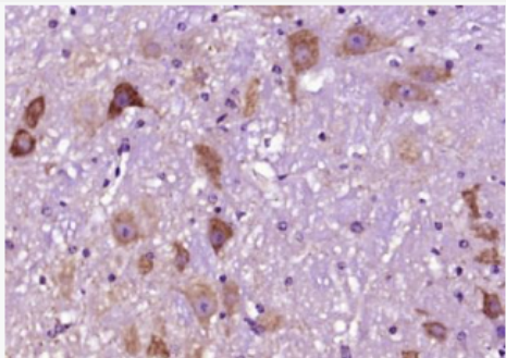 Anti-Syntaxin 13 antibody-神经突触素13抗体