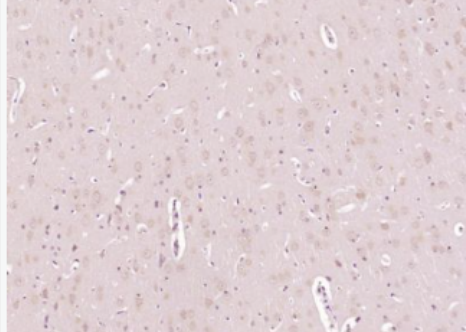 Anti-ARPC5 antibody-肌动蛋白相关蛋白2/3复合体亚基5抗体