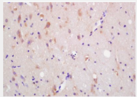 Anti-ACKR3 antibody-细胞表面趋化因子受体7抗体