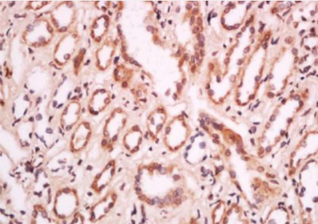 Anti-MELK antibody-蛋白激酶MPK38抗体