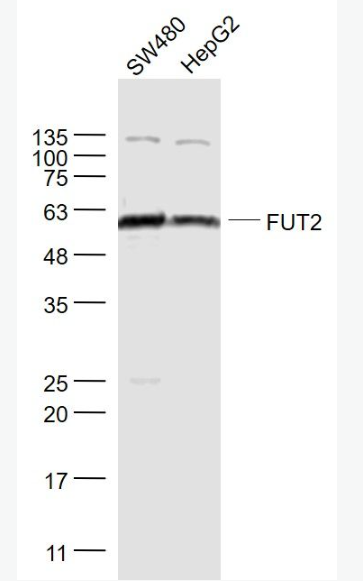 Anti-FUT2 antibody-岩藻糖转移酶2抗体