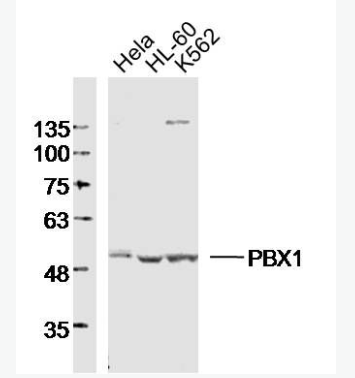 Anti-PBX1 antibody-B淋巴细胞白血病前体蛋白转录因子1抗体
