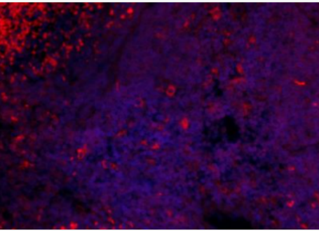 Anti-Stabilin 2 antibody-清道夫受体STAB2抗体