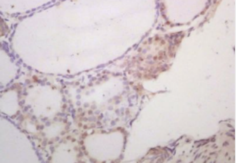 Anti-SCXA antibody-碱性螺旋-环-螺旋转录因子SCXA抗体