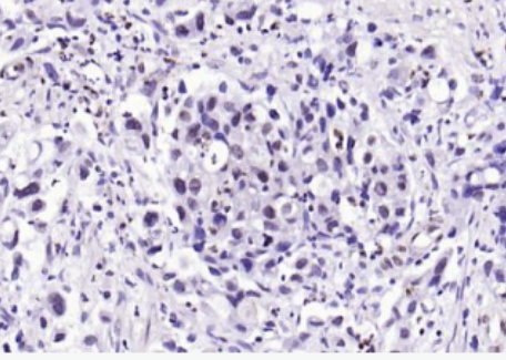 Anti-phospho-SP1 (Thr453) antibody-磷酸化转录生长因子SP1抗体
