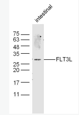 Anti-FLT3L antibody-FMS样酪氨酸激酶3配体抗体