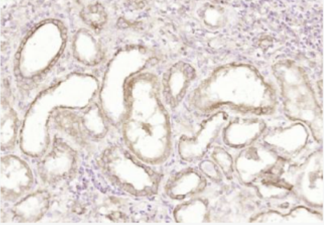 Anti-APOL1 antibody-载脂蛋白L1抗体