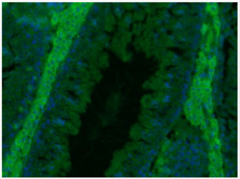 Anti-GAA antibody-α葡萄糖苷酶/溶酶体α-葡糖苷酶抗体
