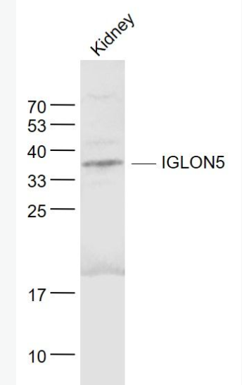 Anti-IGLON5 antibody-IgLON家族蛋白5抗体