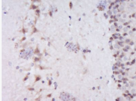 Anti-Dishevelled 2 antibody-蓬乱蛋白2抗体