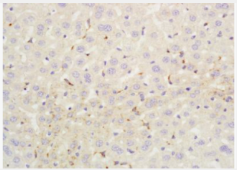 Anti-C4d-A antibody-补体C4d-A蛋白抗体