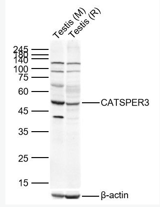 Anti-CATSPER3 antibody-阳离子通道精子相关蛋白3抗体
